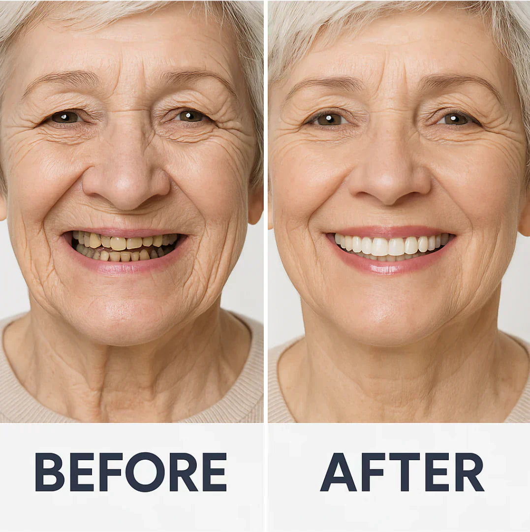 Custom-Fit Functional Dentures