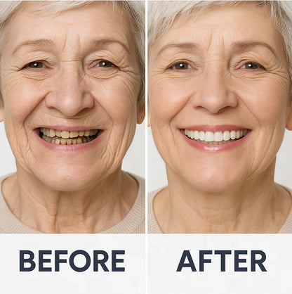 Custom-Fit Functional Dentures